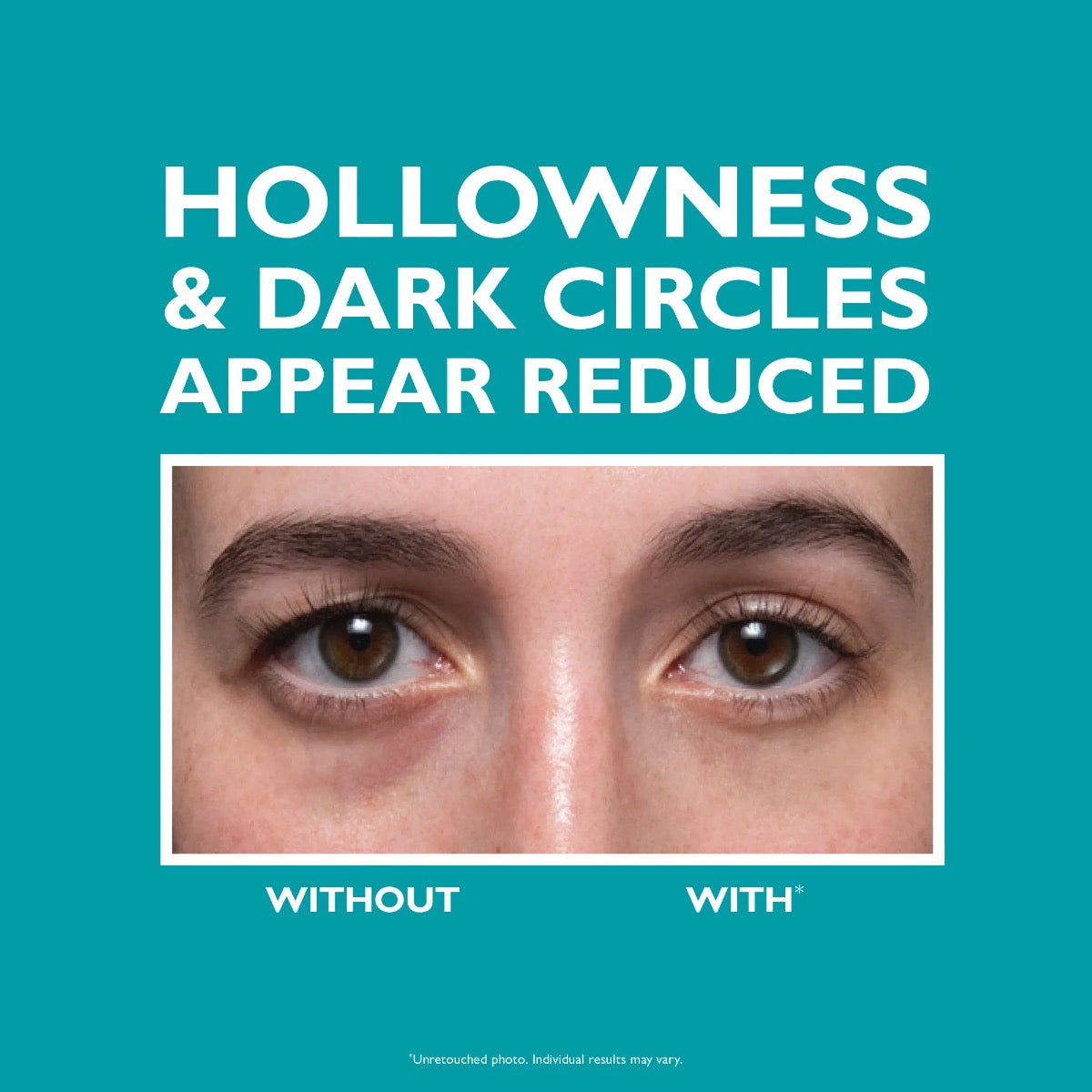 Peptide Skinjection Fill + Fix Under-Eye Cream