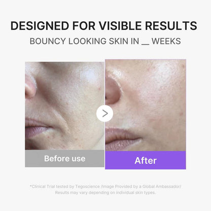 medicube - AGE-R Booster Pro Mini Plus Beige