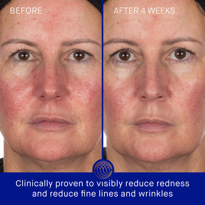 THE HYDROGEL FACE MASK