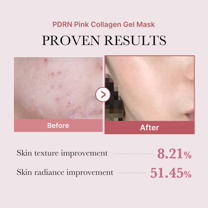 MEDICUBE Salmon PDRN Pink Collagen Jelly Gel Mask