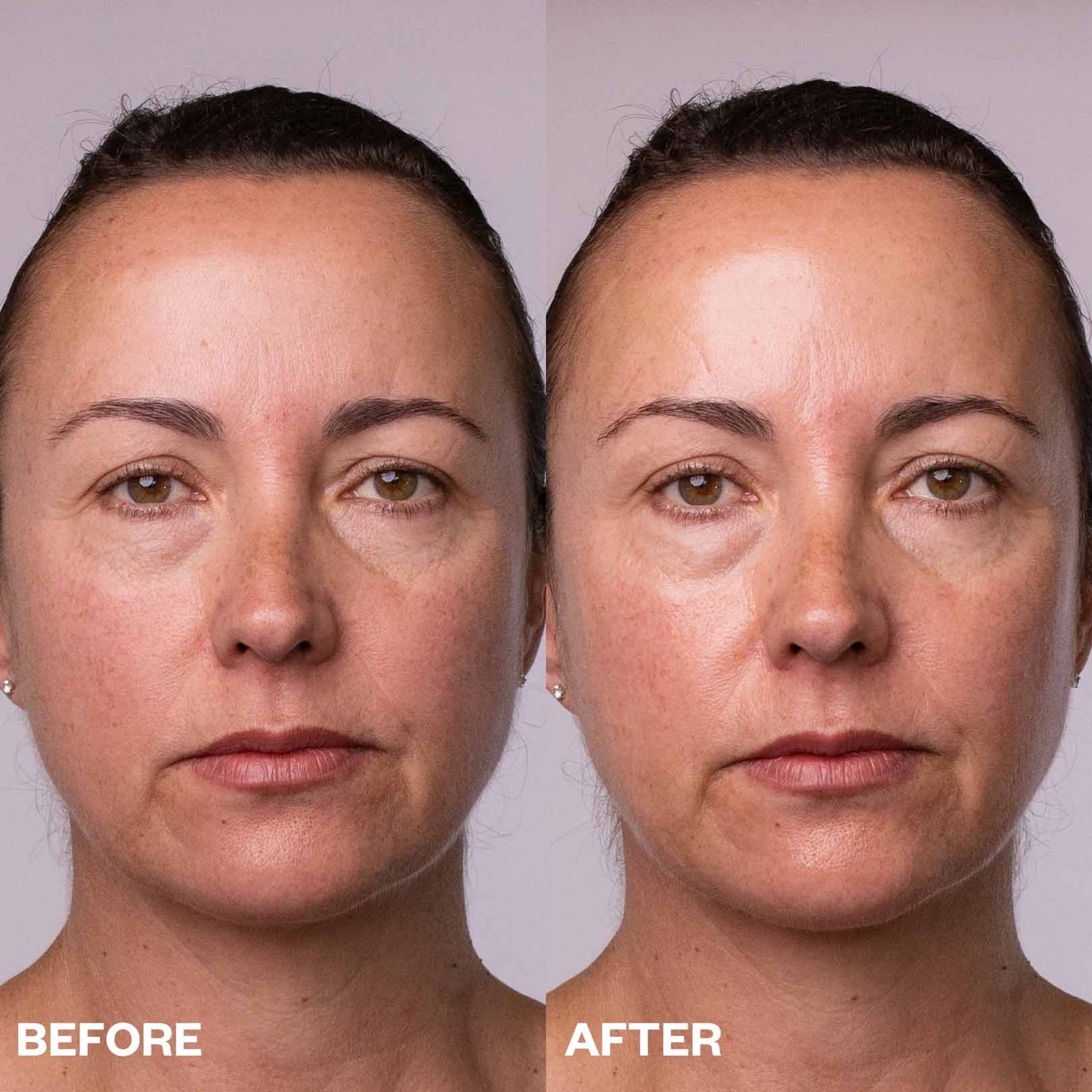 Face Polishing Peel Pads