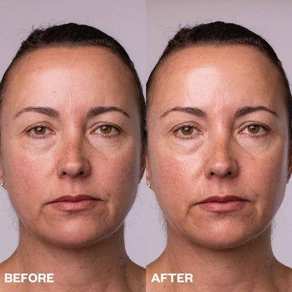 Face Polishing Peel Pads