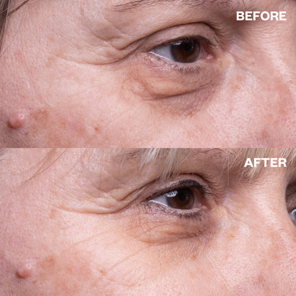 Eye Wrinkle Patches - One Pair