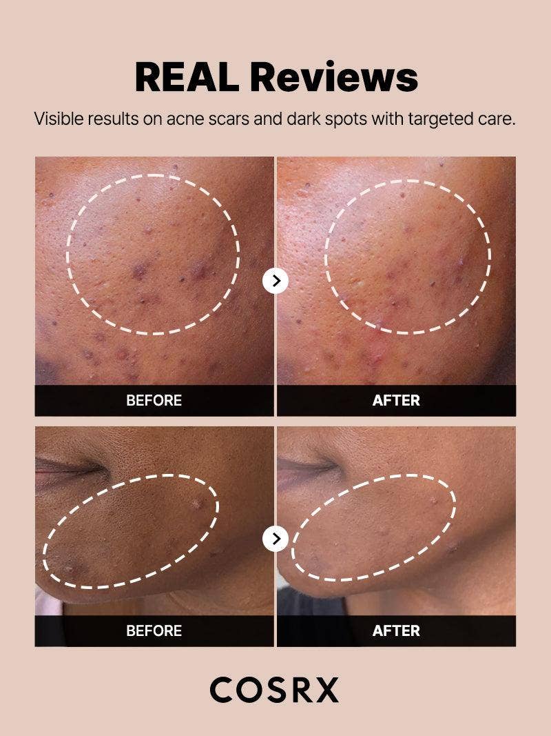 COSRX Alpha-Arbutin 2 Discoloration Care Serum
